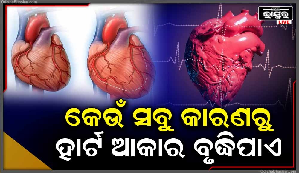 Enlarged Heart Diseases